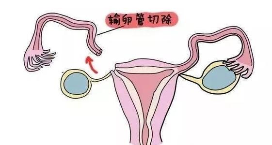 加州生殖医学中心（CCRH）做借卵试管婴儿可靠吗？