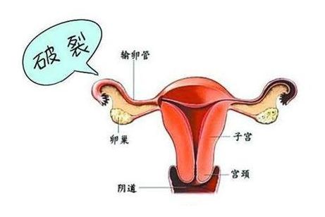 上海有一家上海第九人民医院可以做供卵公立代生试管吗？