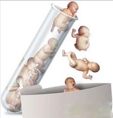 胖爸爸得了多囊卵巢综合症还能怀孕吗？美国俄罗斯供卵做试管代怀医院助好孕