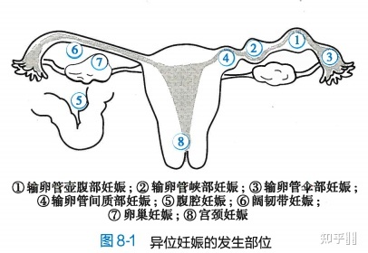 穿刺取精做赠卵供卵自怀医院的成功率高吗？