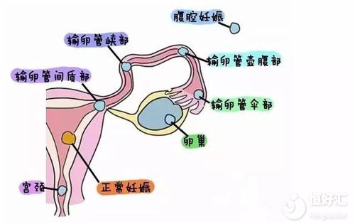 南京鼓楼医院能做三代借卵试管吗做三代借卵试管供卵怎么样