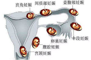 干货分享-分分钟带你了解做赠卵试管婴儿助孕全流程,超实用