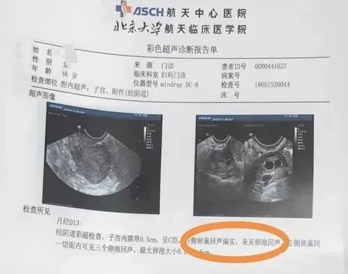 北京供卵试管婴儿费用大约多少
