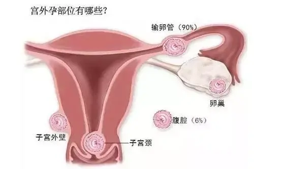 北京做供卵试管费用明细