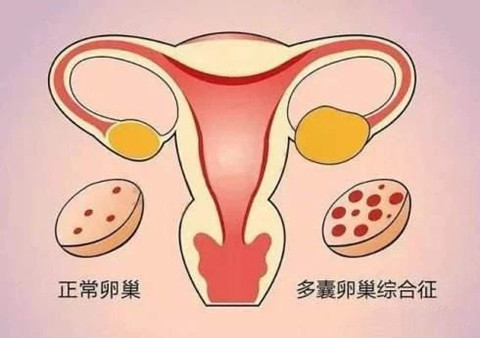 做供卵试管育儿医生说长方案