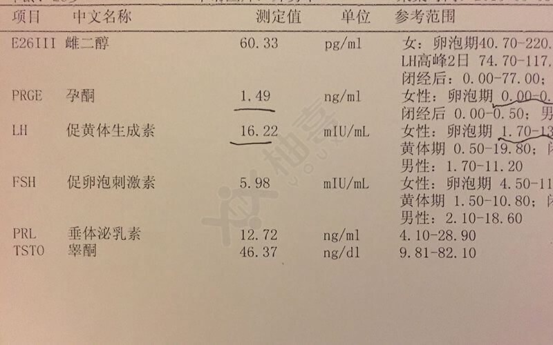 想怀孕生女孩怎么调理身体5种食物得多吃