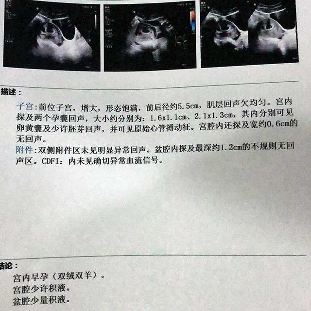 试管妈妈抽烟喝酒对卵子的影响