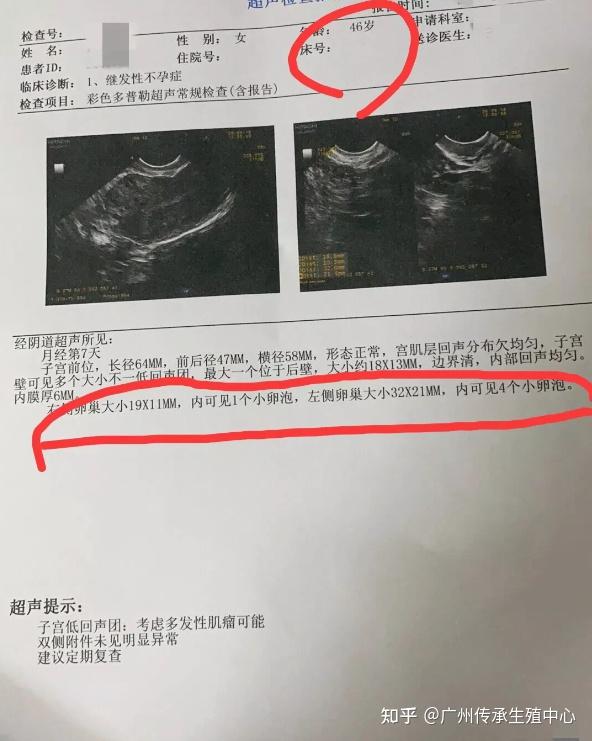 北京有精子库吗+有精子库有卵子库吗
