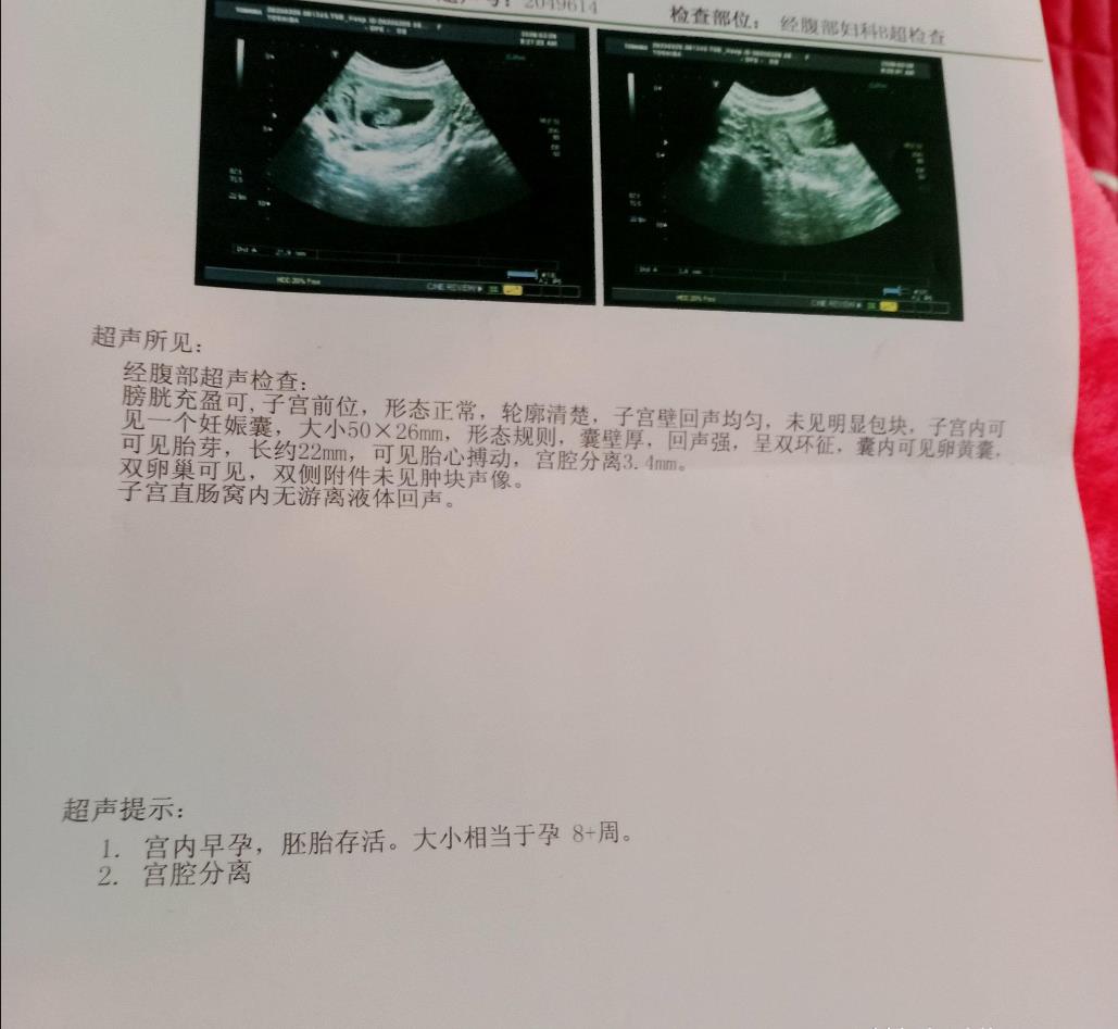 6种材料补办北京出生证明,注意,这类公民一律不补