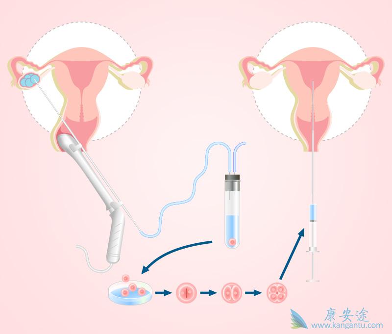 B级精子可试管代怀机构电话受孕,达这个正常标准孕路无阻