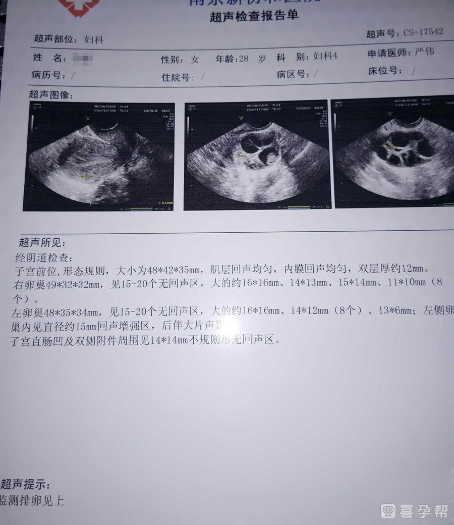 2024年50岁代怀助孕婴儿成功率如何（