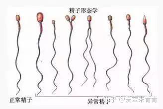 怎么样才能生儿子（精子越浓越能代怀做双胞胎吗）